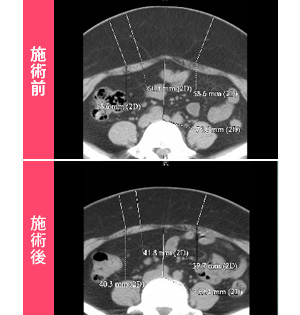 お腹の断面図