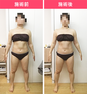 Before After 施術例③ 30代女性