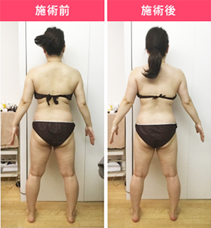 Before After 施術例③ 30代女性