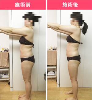 Before After 施術例③ 30代女性