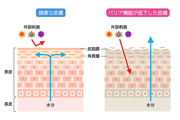 。健康な皮膚のバリア機能